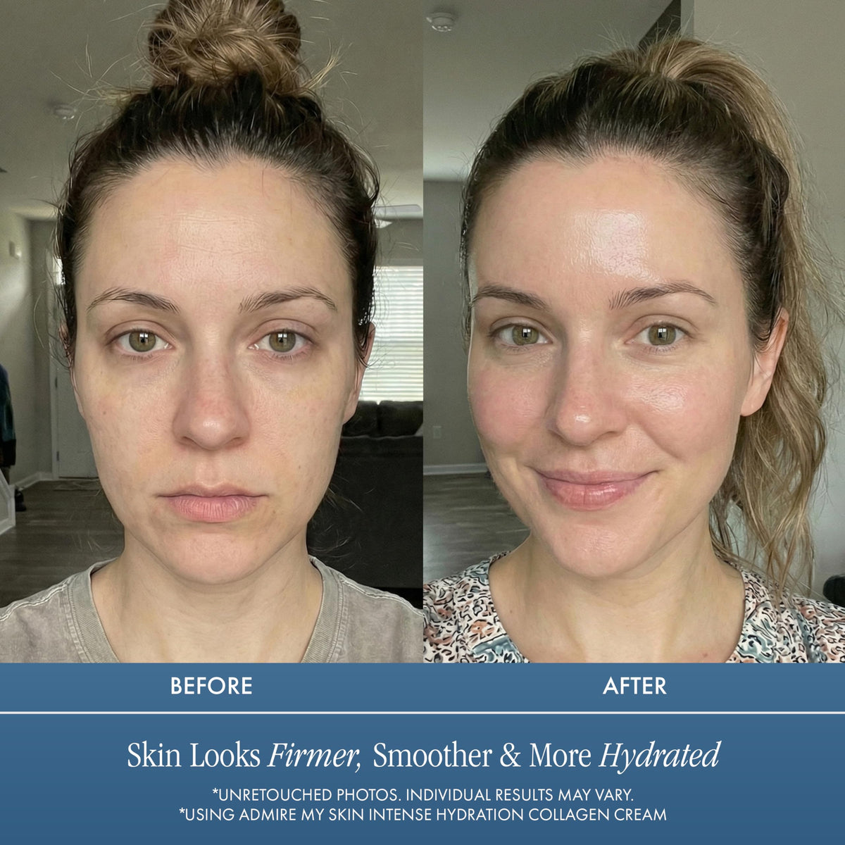 Admire My Skin Collagen Cream Moisturizer For Dry Skin - Hyaluronic Acid Cream - Non Comedogenic Hydrating Cream Eliminates Dull Dry Skin for That Healthy Youthful Glow 2oz